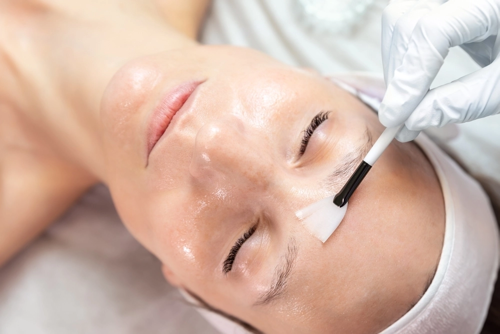 A gloved hand brushing a peel solution across a patient's forehead