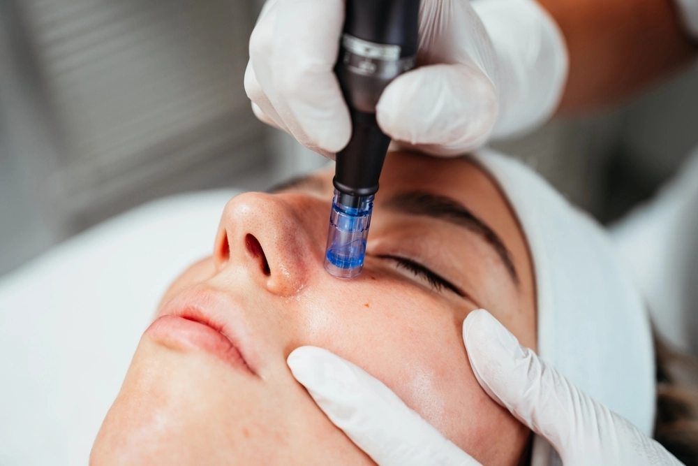 Microneedling pen being used on a patient's cheek