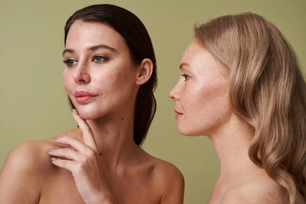 Two women with different skin types against a pale green background